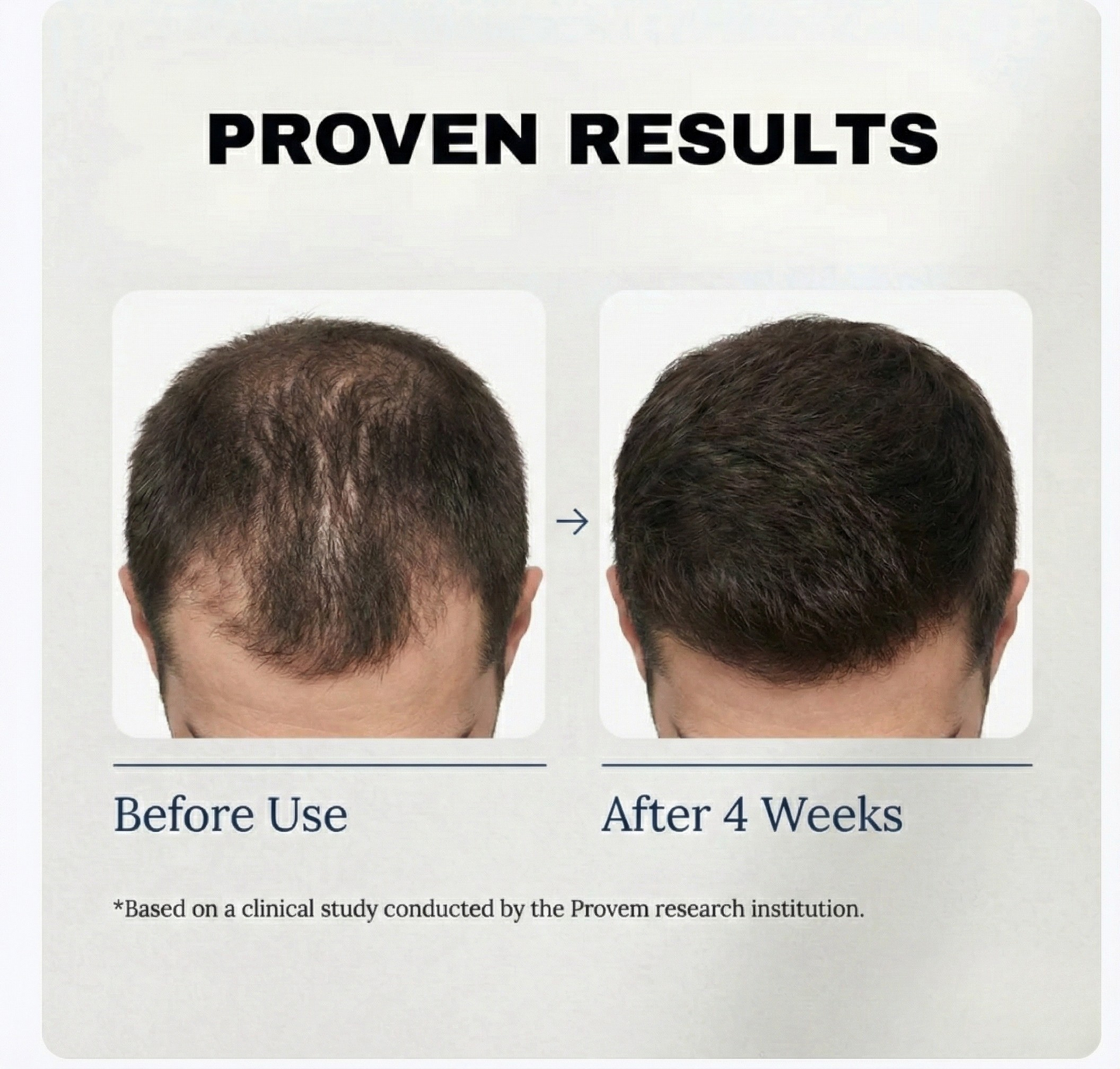 Advanced Roll-On Hair Growth Serum